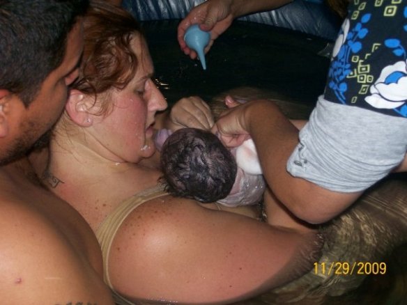 water birth, waterbirth